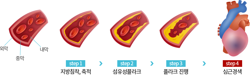 µ¿¸Æ°æÈÁõÀÇ ÁøÇà´Ü°è